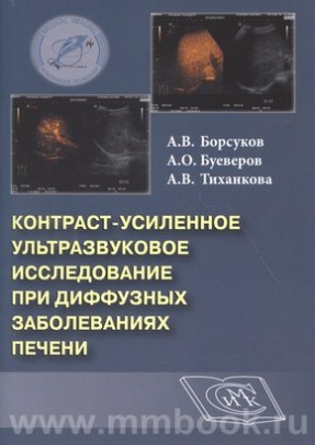 Contrast-enhanced ultrasound (CEUS) in diffuse liver diseases : Methods handbook