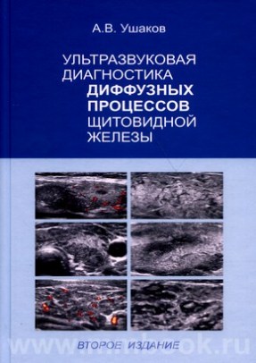 Ультразвуковая диагностика диффузных процессов щитовидной железы 2-е издание