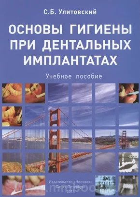 Основы гигиены при дентальных имплантатах