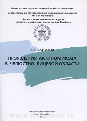 Проявления актиномикоза в челюстно-лицевой области