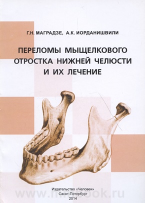 Переломы мыщелкового отростка нижней челюсти и их лечение
