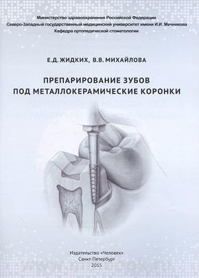 Препарирование зубов под металлокерамические коронки