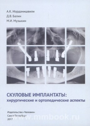 Иорданишвили А.К - Скуловые имплантаты: хирургические и ортопедические аспекты