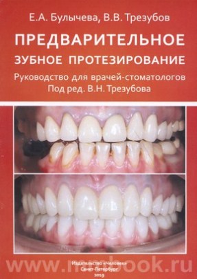 Предварительное зубное протезирование