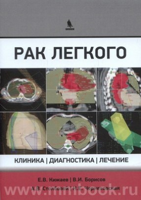 Рак легкого: клиника