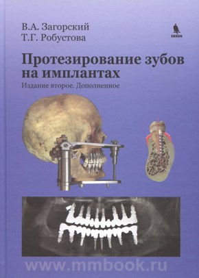 Протезирование зубов на имплантатах. 2-е изд., дополненное 