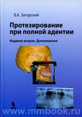 Протезирование при полной адентии