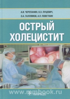 Острый холецистит