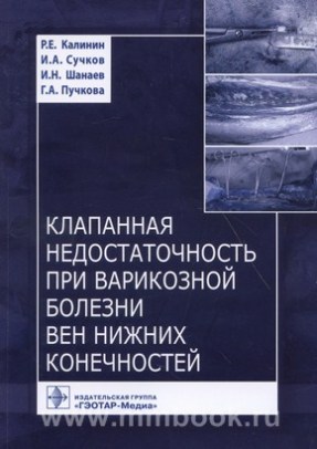 Клапанная недостаточность при варикозной болезни вен нижних конечностей