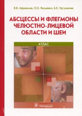 Абсцессы и флегмоны челюстно-лицевой области и шеи. Атлас