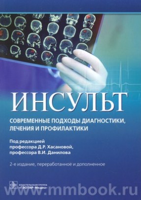 Инсульт. Современные подходы диагностики