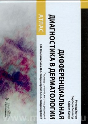 Дифференциальная диагностика в дерматологии. Атлас 