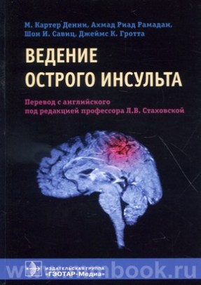 Ведение острого инсульта