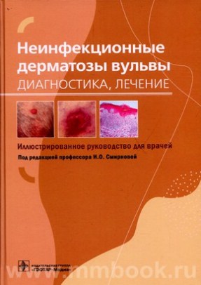 Неинфекционные дерматозы вульвы: диагностика, лечение : иллюстрированное руководство для врачей