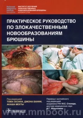 Практическое руководство по злокачественным новообразованиям брюшины