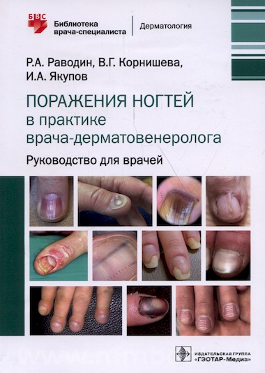 Поражения ногтей в практике врача-дерматовенеролога : руководство для врачей