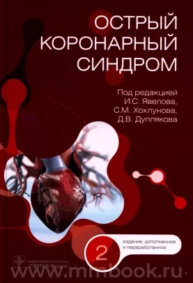Острый коронарный синдром
