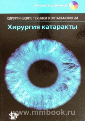 Хирургия катаракты