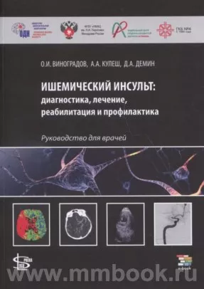 Ишемический инсульт: диагностика, лечение