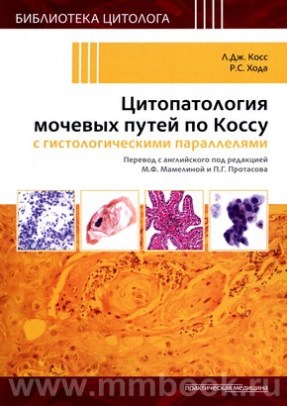Цитопатология мочевых путей по Коссу с гистологическими параллелями