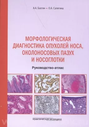 Морфологическая диагностика опухолей носа, околоносовых пазух и носоглотки