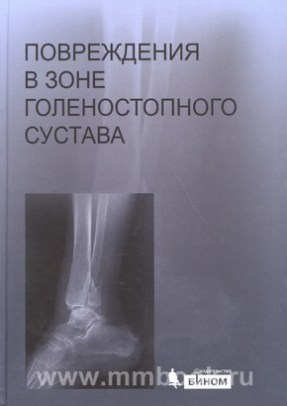 Повреждения в зоне голеностопного сустава с CD