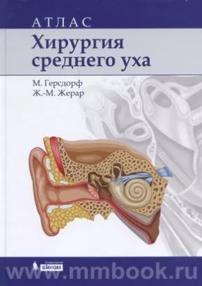 Хирургия среднего уха: атлас