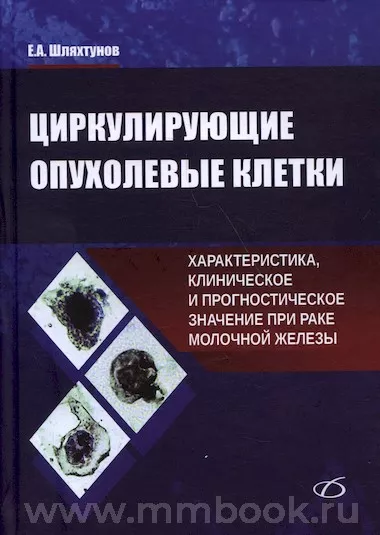 Циркулирующие опухолевые клетки: характеристика, клиническое и прогностическое значение при раке молочной железы