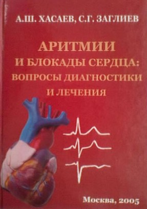 Аритмии и блокады сердца: вопросы диагностики и лечения