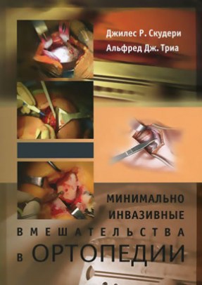 Минимально инвазивные вмешательства в ортопедии комплект в 2 томах